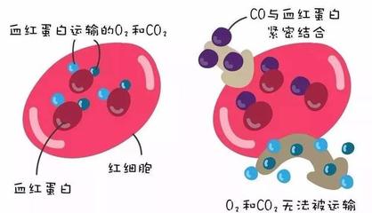 警惕洗澡季隱形殺手 一氧化碳中毒康復后，當心遲發性腦病